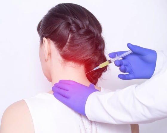 Cervical Epidural Injection