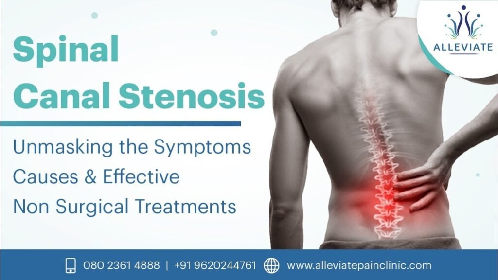 Spinal Canal Stenosis Symptoms Causes and Effective Non Surgical Treatments