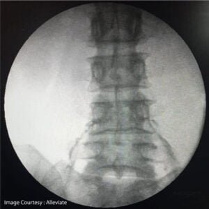 scan image3