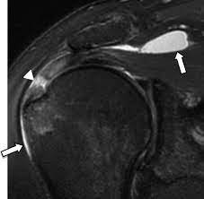 MRI Scan232