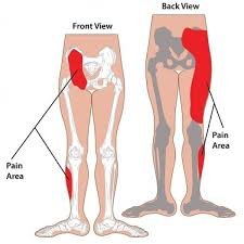 Joint pain1