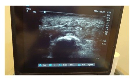 ultrasound