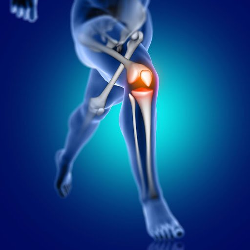 Osteoarthritis