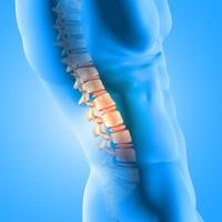 Back Pain
