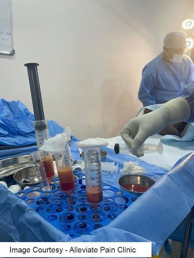 Adipose derived stem cell preparation