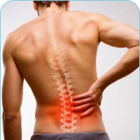 Myofascial Pain Syndrome