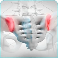 Sacroiliac Joint Dysfunction